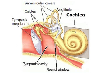 Sensorineural Hearing Loss